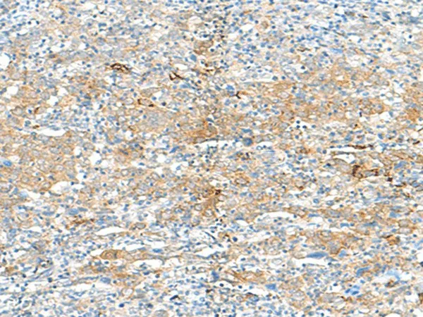 HLA-DRB3 Polyclonal Antibody - image 1