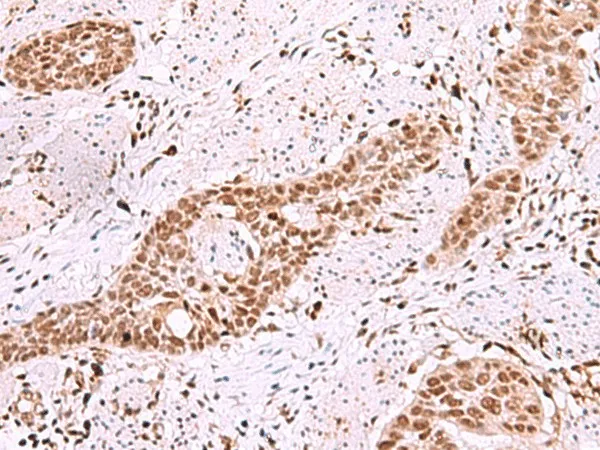 ISL2 Polyclonal Antibody - image 1