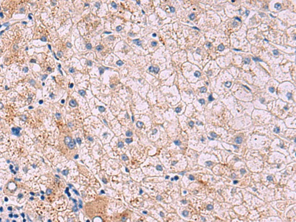 JAM3 Polyclonal Antibody - image 1