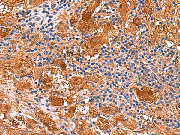 KANK3 Polyclonal Antibody - image 1