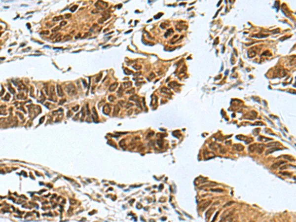 PDCD5 Polyclonal Antibody - image 1