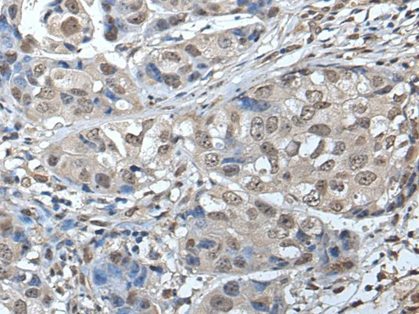 SMC1A Polyclonal Antibody - image 1