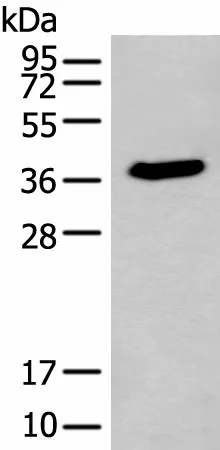 ACBD4 Polyclonal Antibody - image 1