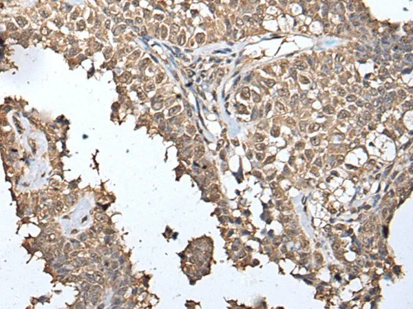 METAP1D Polyclonal Antibody - image 1