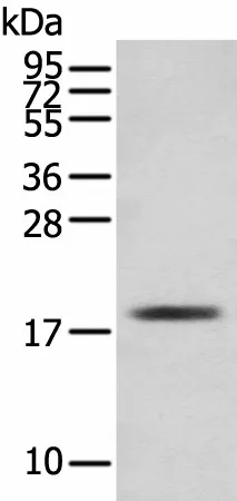 TNNC1 Polyclonal Antibody - image 1