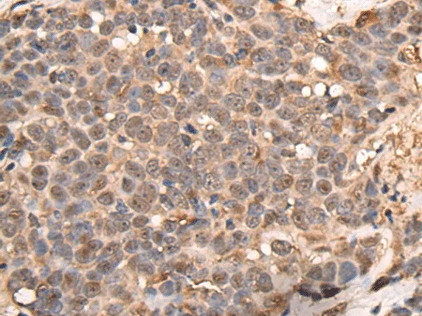 ATRIP Polyclonal Antibody - image 1