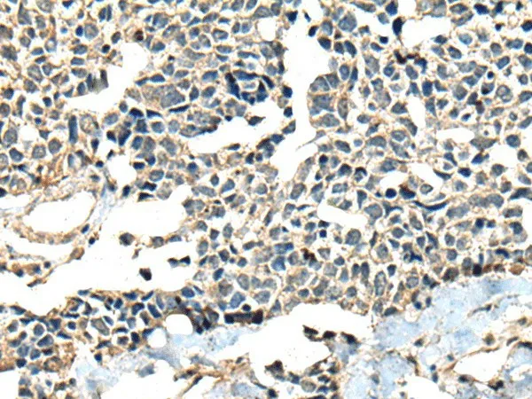 CALHM1 Polyclonal Antibody - image 1