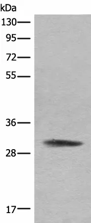 COMT Polyclonal Antibody - image 1