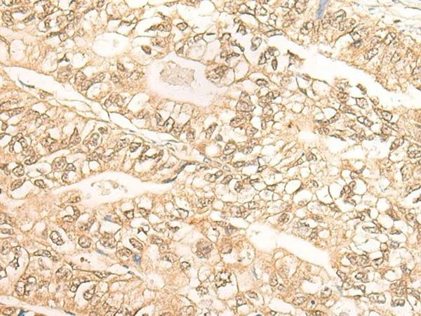 DMC1 Polyclonal Antibody - image 1