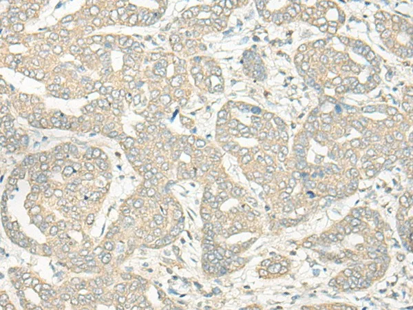 HLA-DRB5 Polyclonal Antibody - image 1