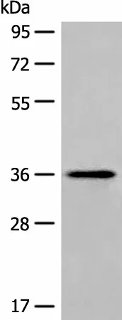 MLST8 Polyclonal Antibody - image 1