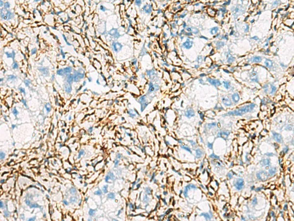 ACTC1 Polyclonal Antibody - image 1