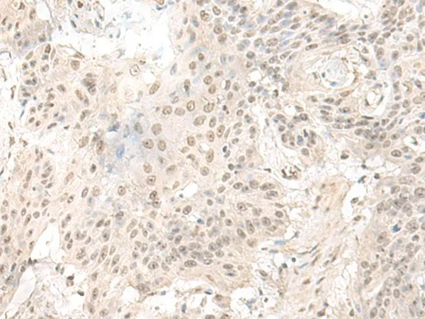 ILKAP Polyclonal Antibody - image 1