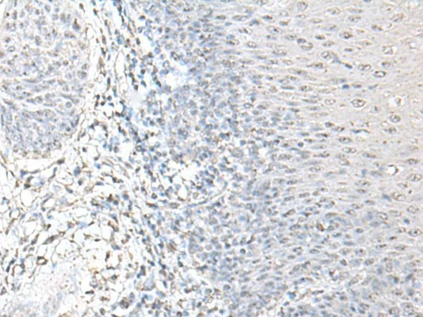 EPM2A Polyclonal Antibody - image 1