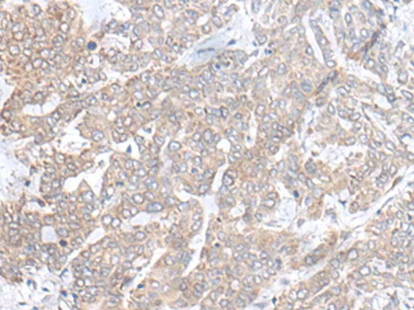 PLGLB2 Polyclonal Antibody - image 1