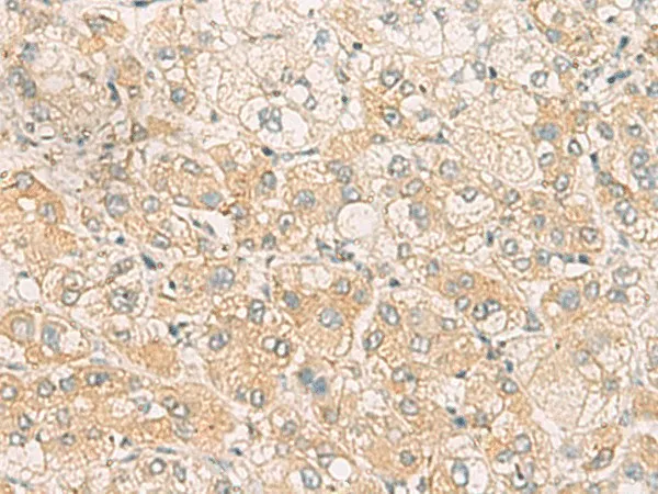 SYNGR1 Polyclonal Antibody - image 1