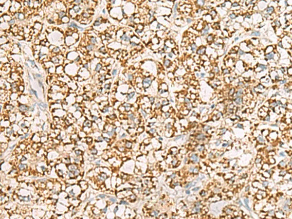 ISOC2 Polyclonal Antibody - image 1