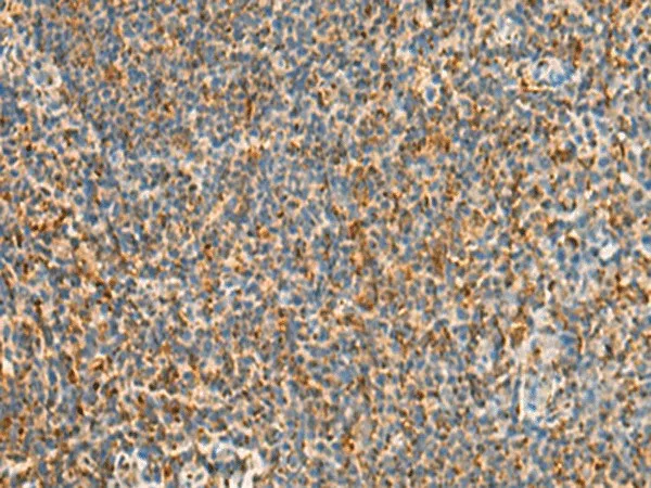 STK32C Polyclonal Antibody - image 1