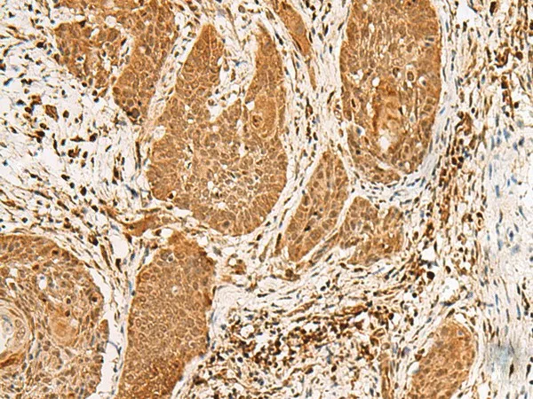 PPOX Polyclonal Antibody - image 1