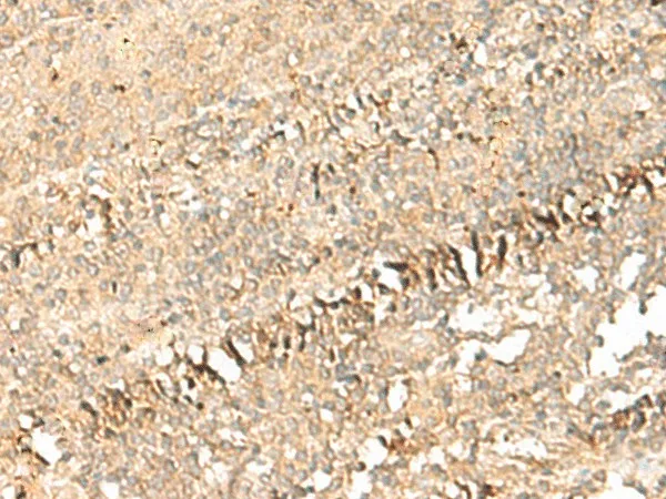PSD4 Polyclonal Antibody - image 1
