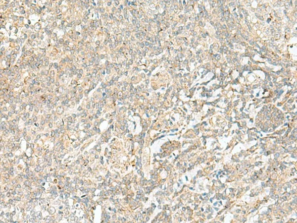BEX2 Polyclonal Antibody - image 1