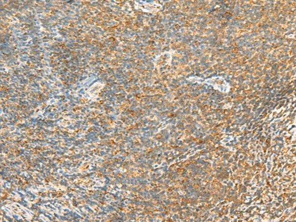 MTHFD2L Polyclonal Antibody - image 1