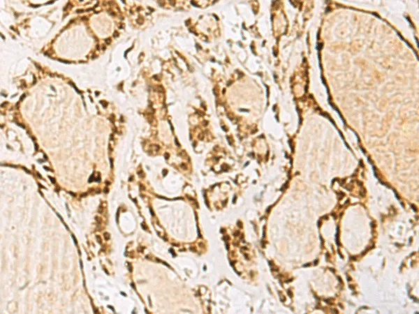 NIPBL Polyclonal Antibody - image 1