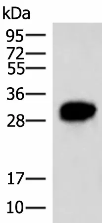 HCCS Polyclonal Antibody - image 1