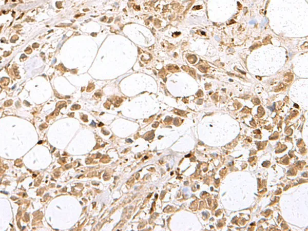 RBFOX2 Polyclonal Antibody - image 1