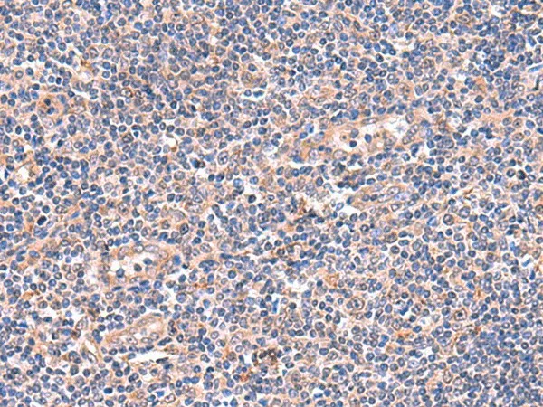 OSBPL2 Polyclonal Antibody - image 1