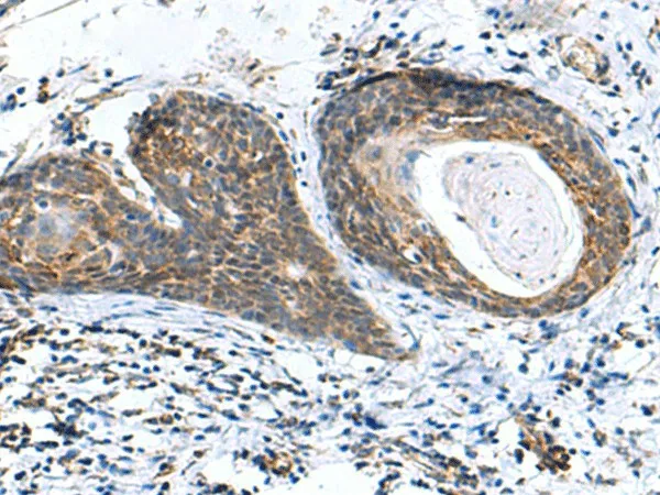 AP1S3 Polyclonal Antibody - image 1