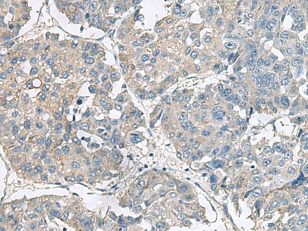 NPHP1 Polyclonal Antibody - image 1