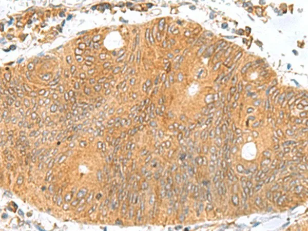 TXNDC12 Polyclonal Antibody - image 1