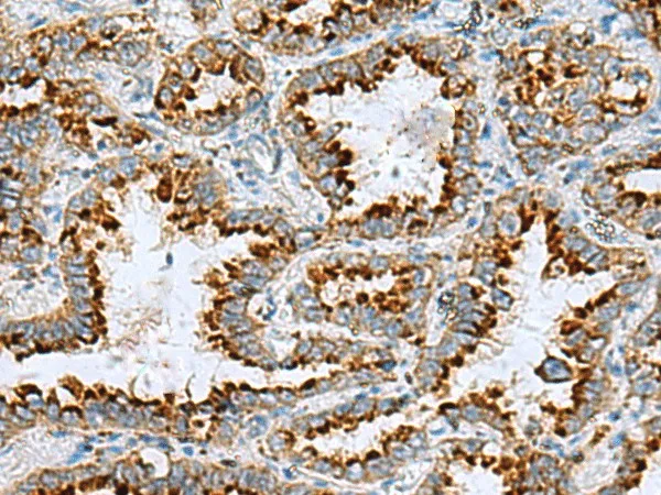 FAAP100 Polyclonal Antibody - image 1