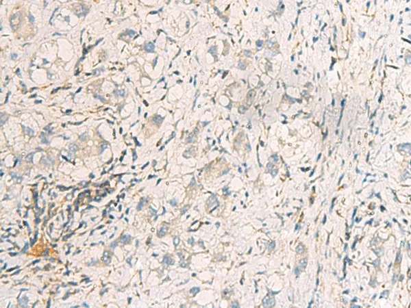 SUSD3 Polyclonal Antibody - image 1
