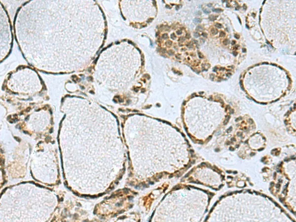 PTPA Polyclonal Antibody - image 1