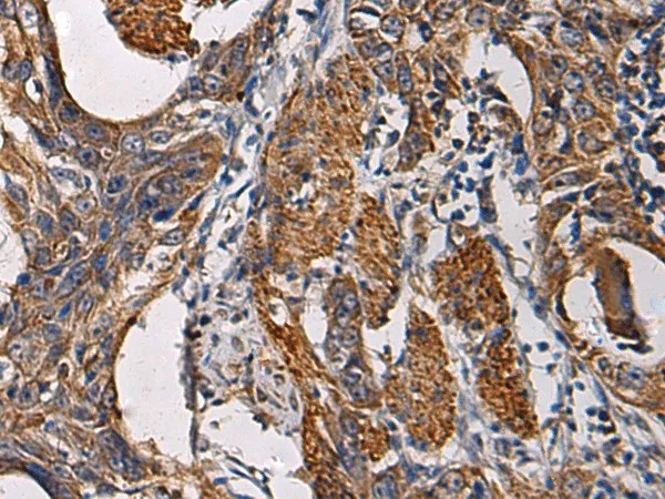 SSH3 Polyclonal Antibody - image 1