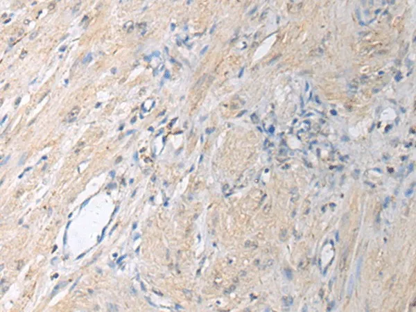 GNAI1 Polyclonal Antibody - image 1