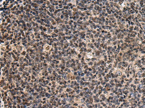 SIK3 Polyclonal Antibody - image 1
