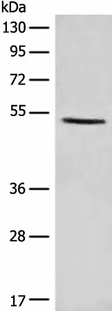 PTEN Polyclonal Antibody - image 1