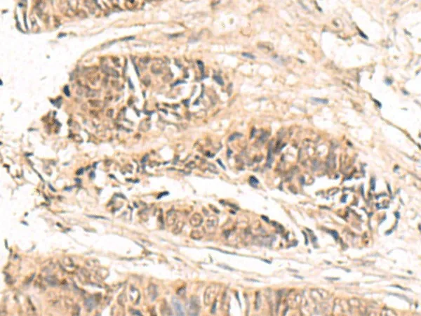 ABCB4 Polyclonal Antibody - image 1
