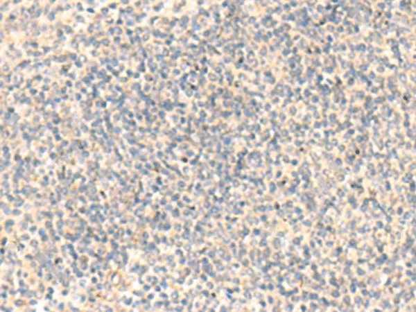 ADAMTS2 Polyclonal Antibody - image 1