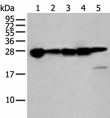 HSPB1 Polyclonal Antibody - image 1