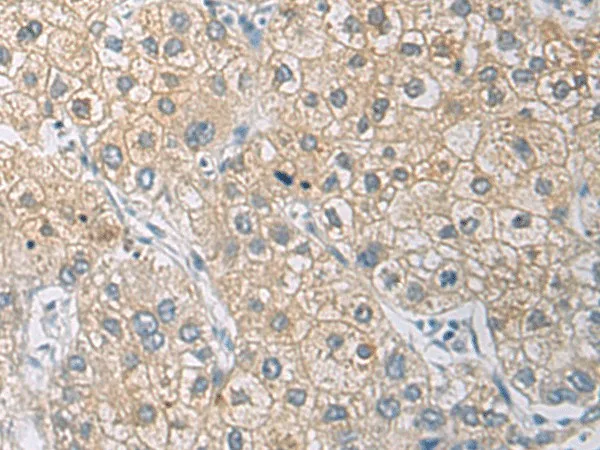IL1RN Polyclonal Antibody - image 1