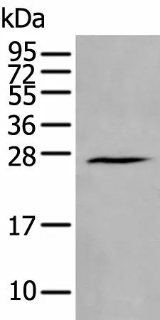 HAND1 Polyclonal Antibody - image 1