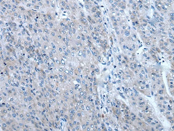 ZIC1 Polyclonal Antibody - image 1