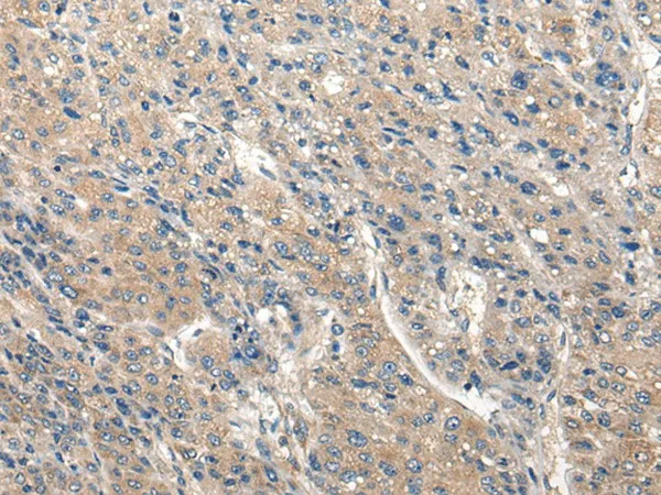 CLIC6 Polyclonal Antibody - image 1