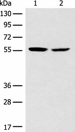 CORO2B Polyclonal Antibody - image 1