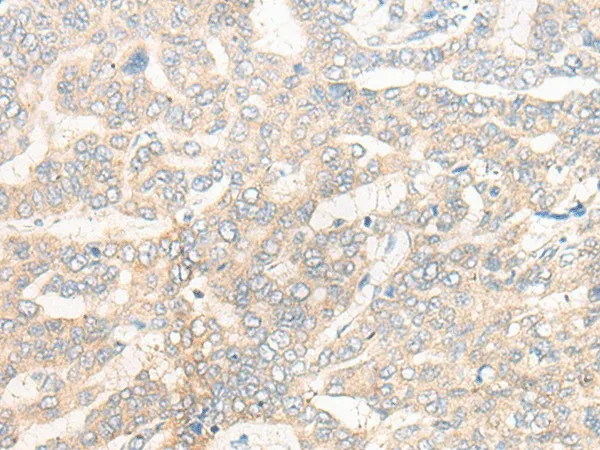 CYB5R3 Polyclonal Antibody - image 1