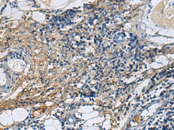 PROC Polyclonal Antibody - image 1